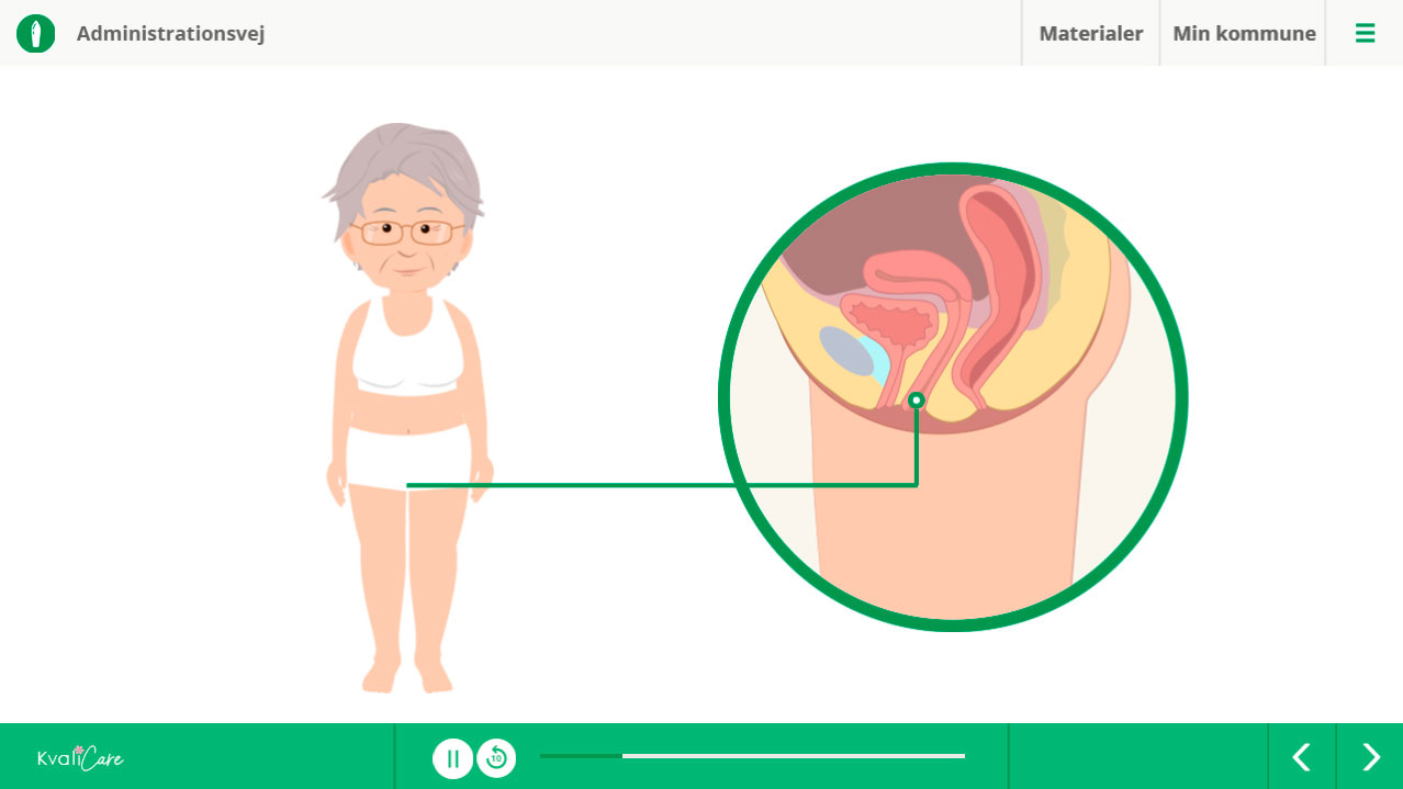 Eksempel på administrationsvej ved vagitorier og vaginaltabletter