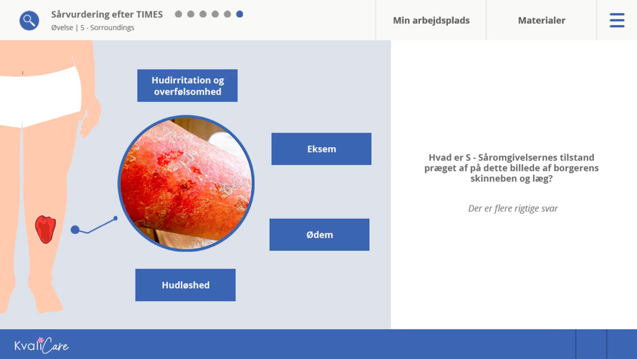 E-læring om sår og TIME-modellen
